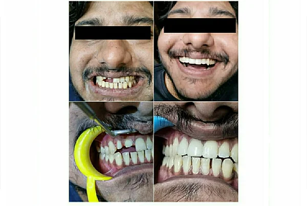 Dental Treatments