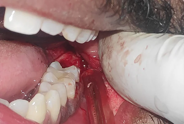 Dental Treatments