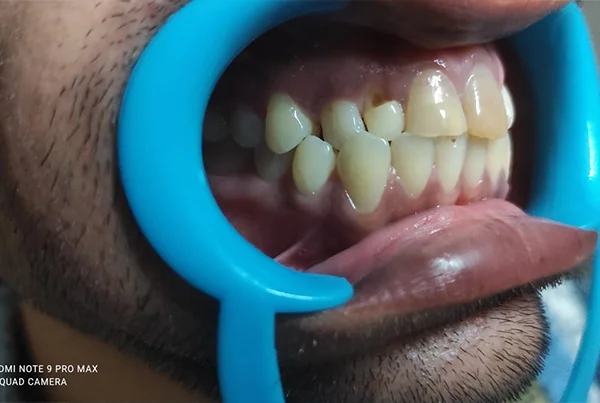 Dental Treatments