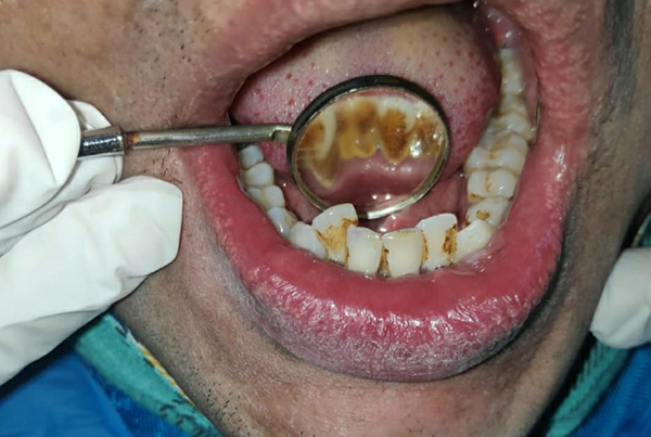 Dental Treatments
