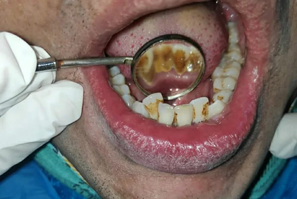 Dental Treatments