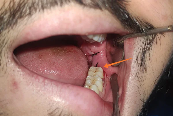 Dental Treatments