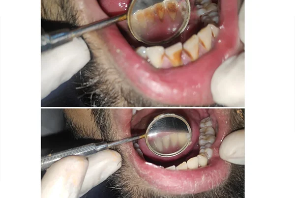 Dental Treatments