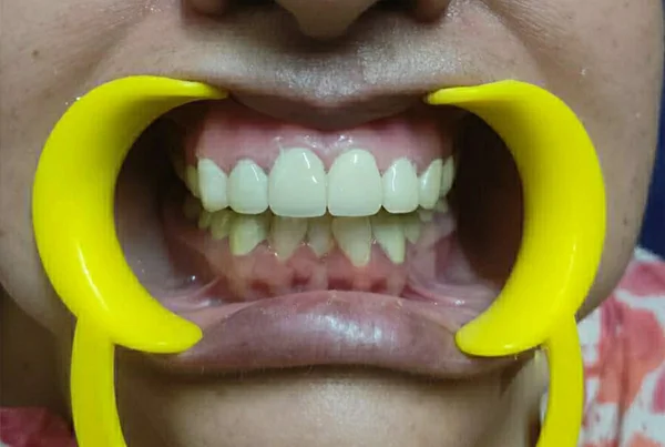 Dental Treatments