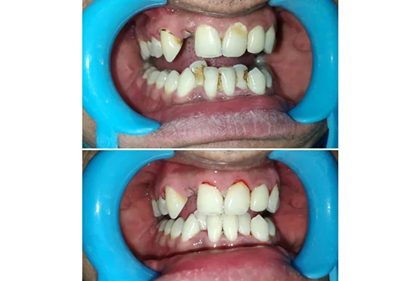 Dental Treatments