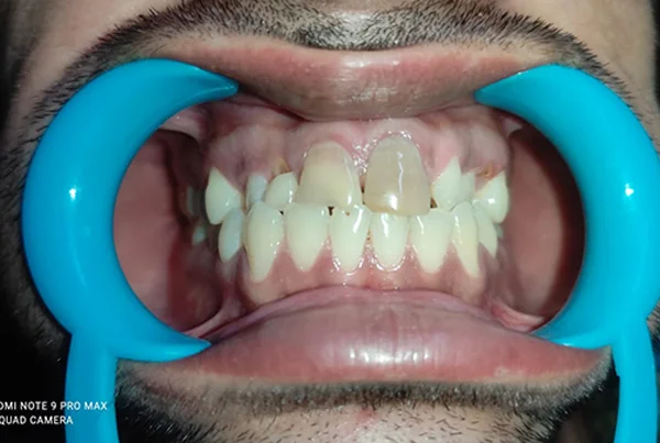 Dental Treatments