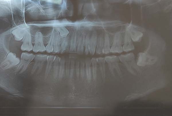Dental Treatments