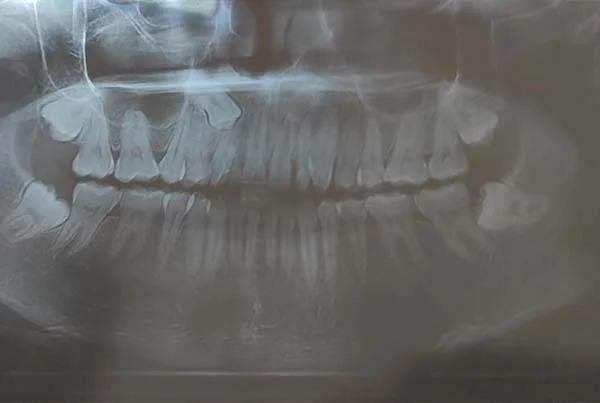 Dental Treatments