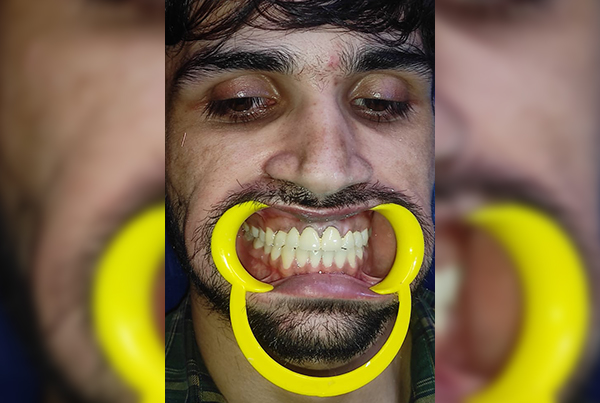 Dental Treatments