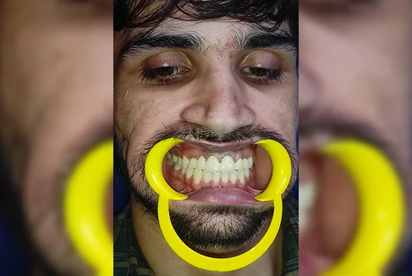 Dental Treatments