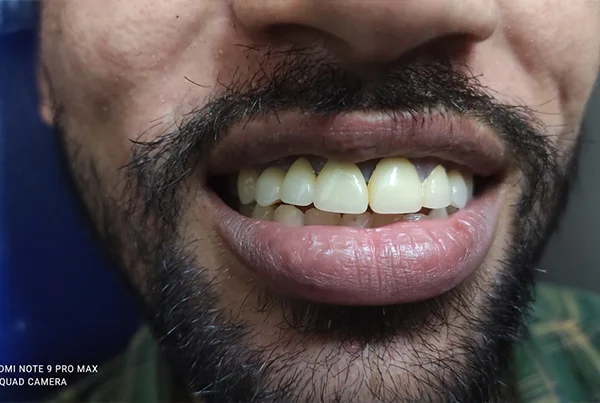Dental Treatments