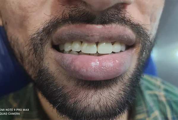 Dental Treatments