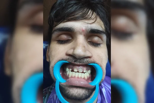 Dental Treatments