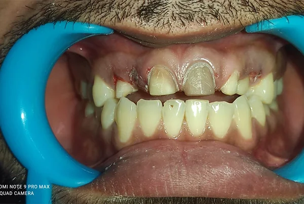 Dental Treatments