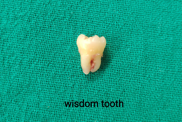 Dental Treatments