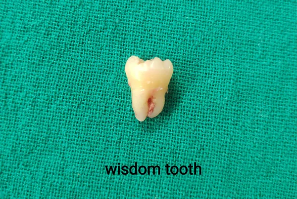 Dental Treatments