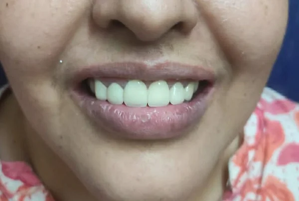 Dental Treatments