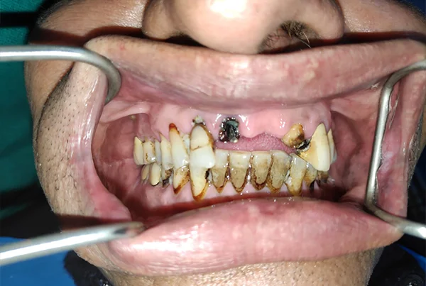 Dental Treatments
