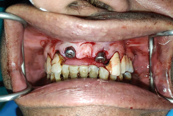 Dental Treatments