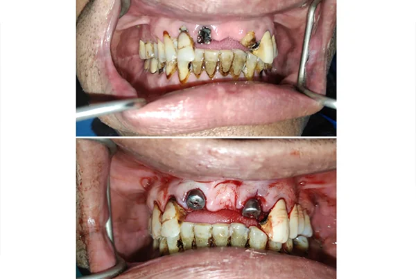 Dental Treatments