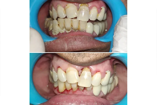 Dental Treatments
