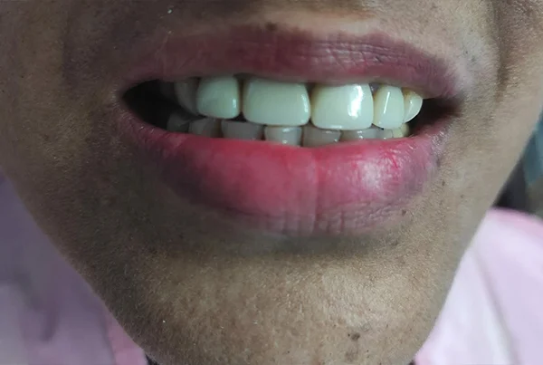Dental Treatments
