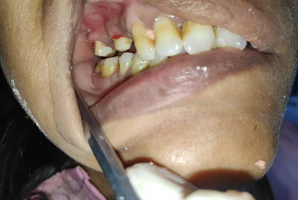 Dental Treatments