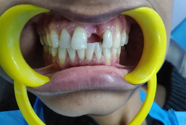 Dental Treatments