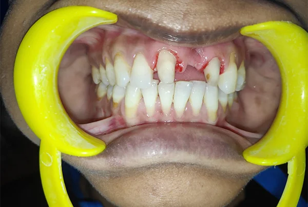 Dental Treatments