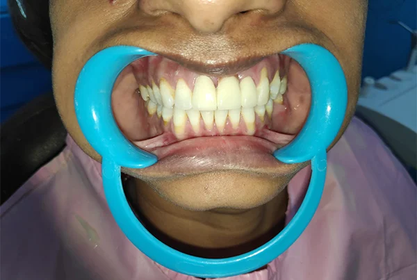 Dental Treatments
