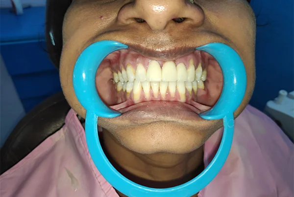 Dental Treatments