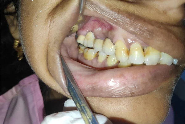 Dental Treatments