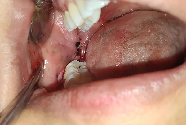 Dental Treatments