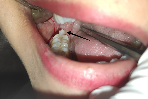 Dental Treatments