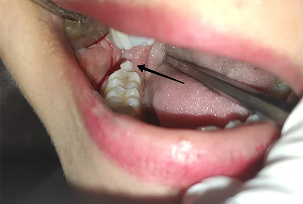 Dental Treatments
