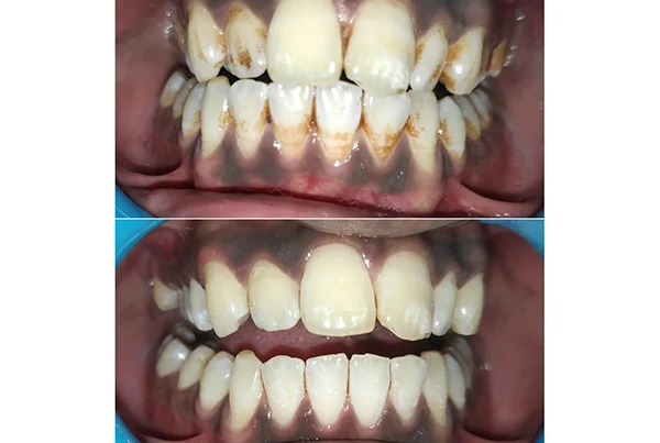 Dental Treatments