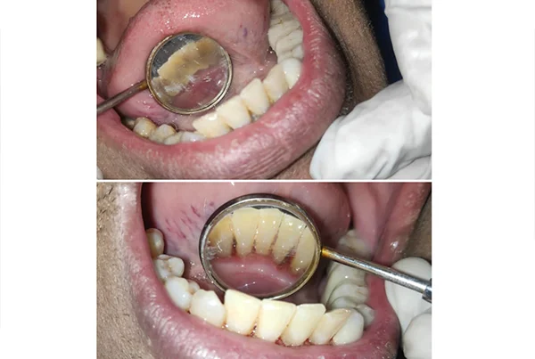 Dental Treatments