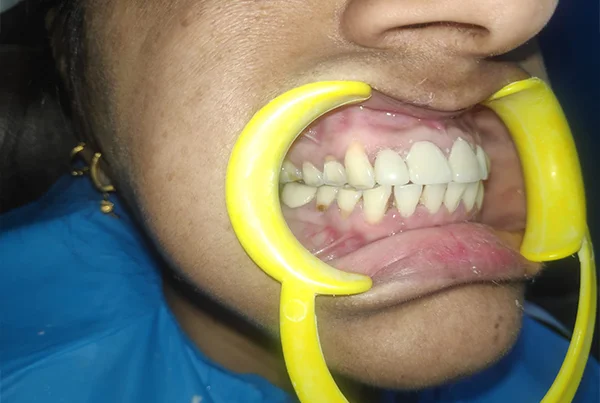 Dental Treatments