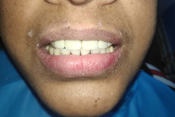 Dental Treatments