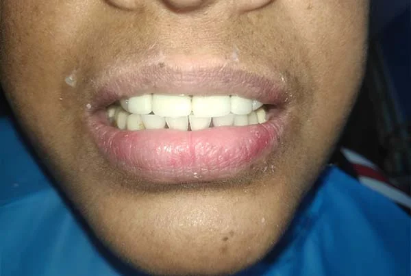 Dental Treatments