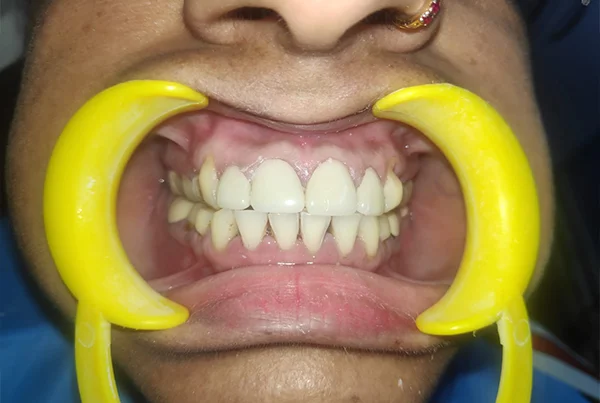 Dental Treatments
