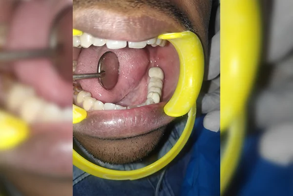 Dental Treatments