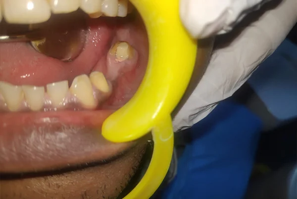 Dental Treatments