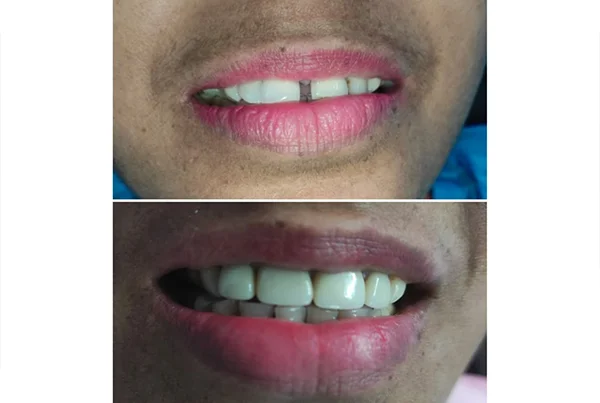 Dental Treatments