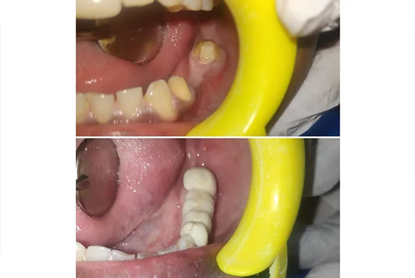Dental Treatments