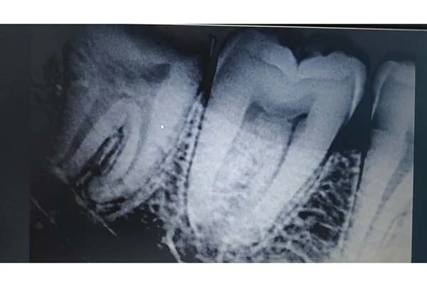 Dental Treatments