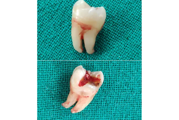 Dental Treatments