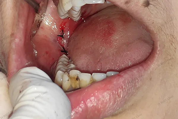 Dental Treatments