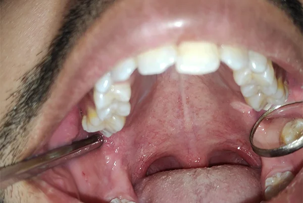 Dental Treatments