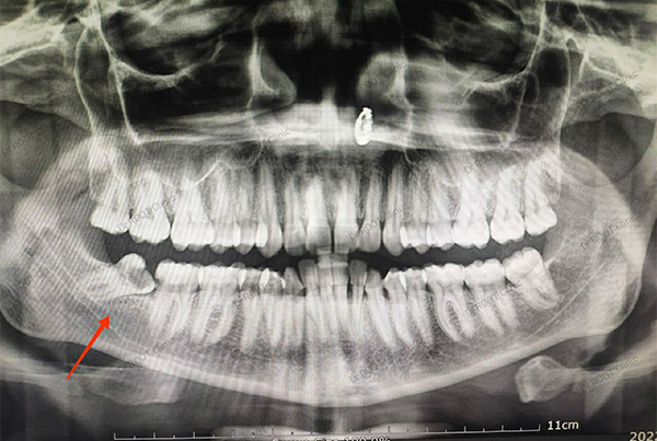 Dental Treatments
